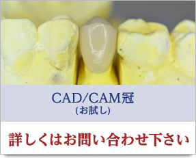 CAD/CAM冠(お試し) 詳しくはお問い合わせ下さい。